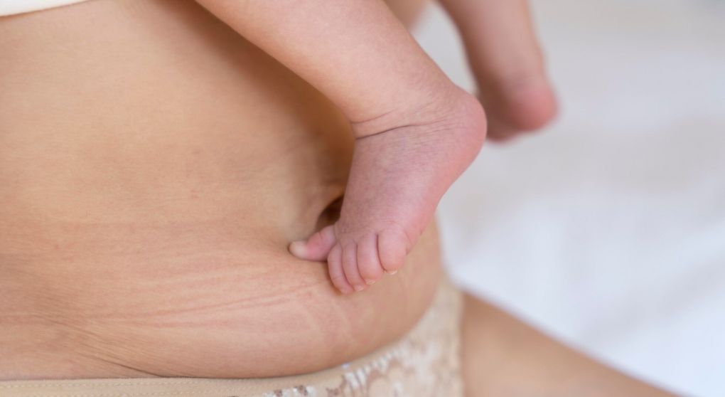 What No One Tells You About Postpartum Depletion